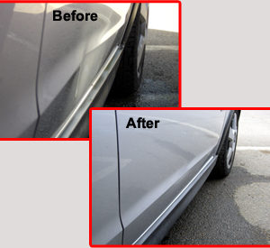 Paintless Dent Removal